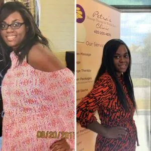 Before and after Vevazz Laser Lipo at Petra's Weight Loss Clinic in Oklahoma City