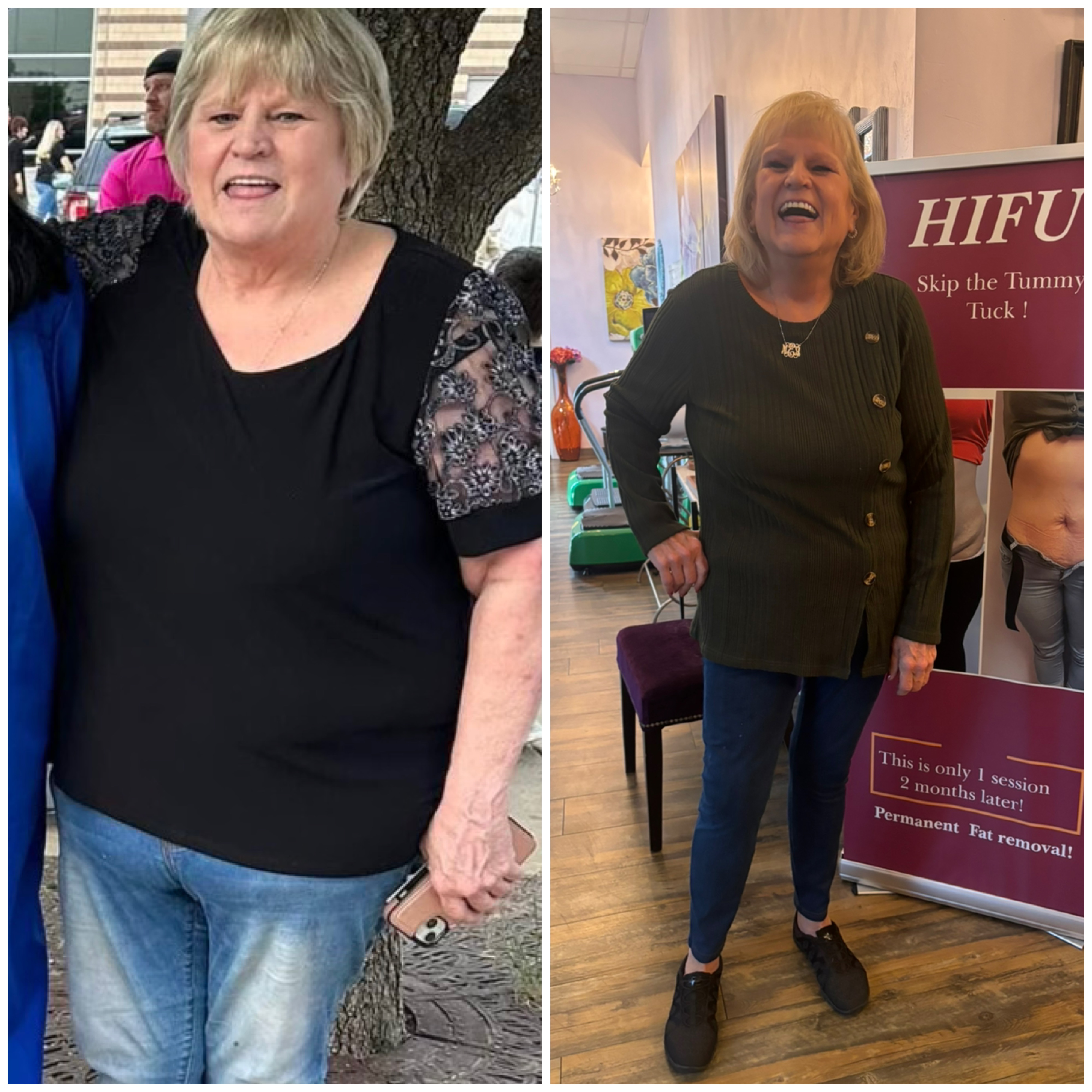 Before and after Petra's client Mary, size 24 to size 9 in five months