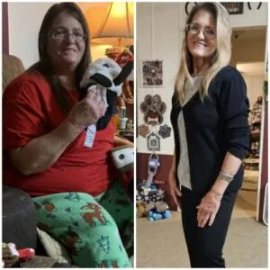 Before and after Vevazz Laser Lipo at Petra's Weight Loss Clinic in Oklahoma City
