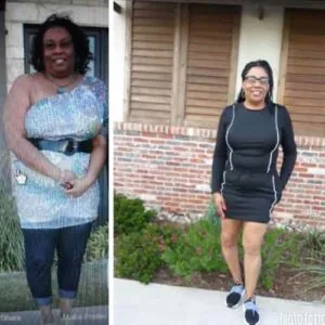Before and after Vevazz Laser Lipo at Petra's Weight Loss Clinic in Oklahoma City
