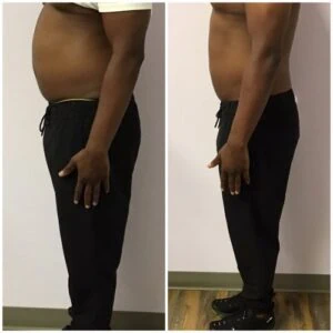 Before and after Body Sculpting at Petra's Weight Loss Clinic in Oklahoma City