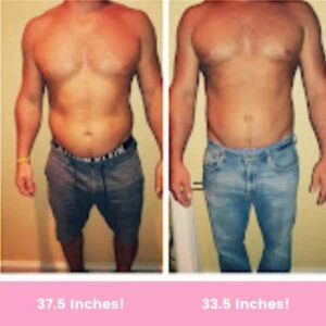 Before and after Body Shape at Petra's Weight Loss Clinic in Oklahoma City